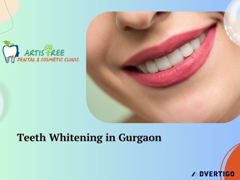 Teeth whitening treatment in gurgaon | artistree dental and cosm