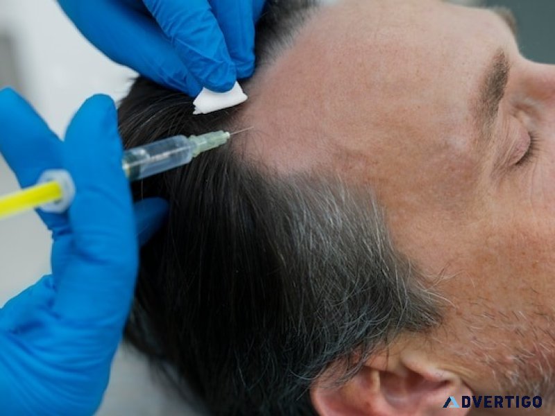 Best hair transplant clinic in india for advanced restoration
