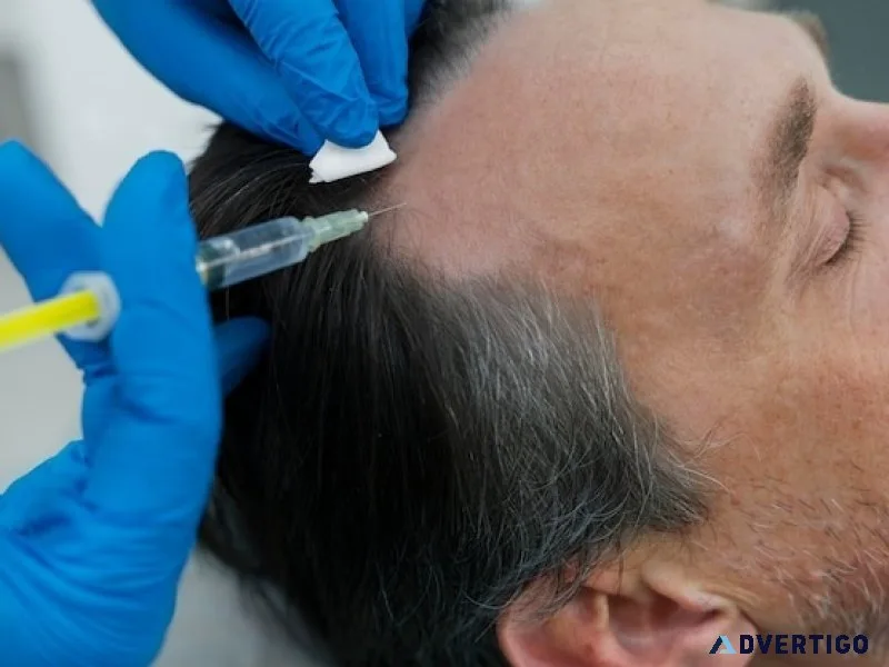 Best hair transplant clinic in india for advanced restoration