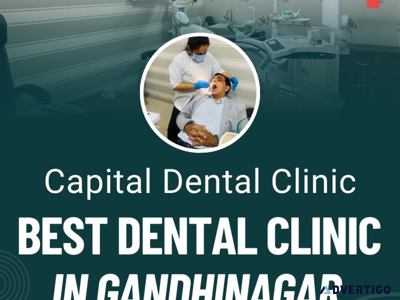Best dental clinic in gandhinagar – capital dental clinic
