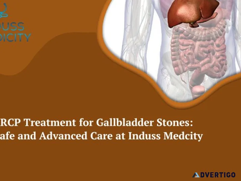Ercp treatment for gallbladder stones | induss medicity