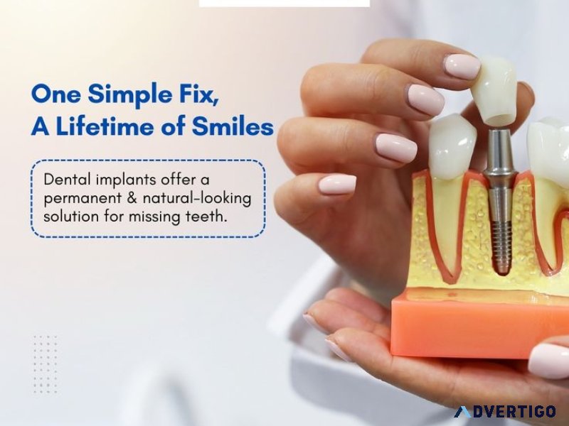 Confidental dental clinic and implant center in wakad |best orth