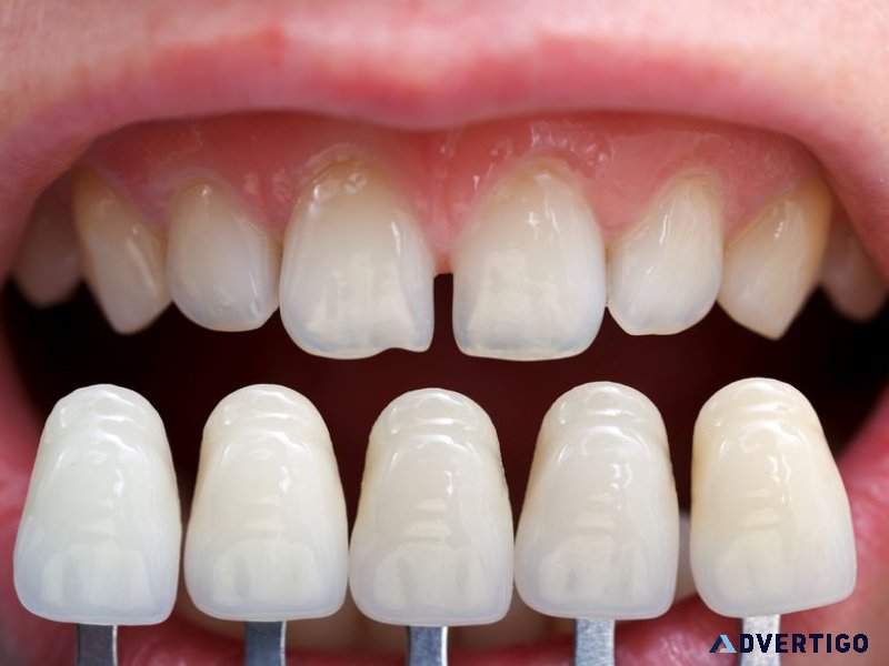 Best dental clinic in jivraj park