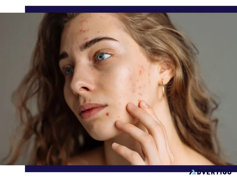 Dermiq clinic: best skin clinic in hyderabad