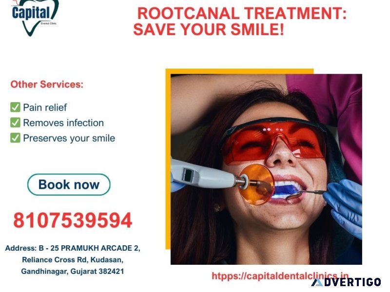  Gentle Pain-Free Root Canal Treatment at Capital Dental