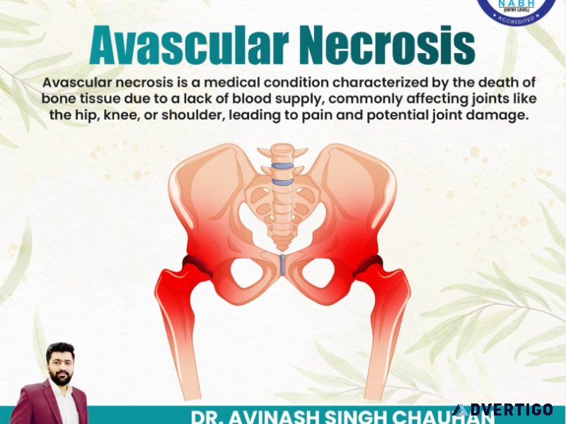 India’s best doctor for avascular necrosis – treat without surge