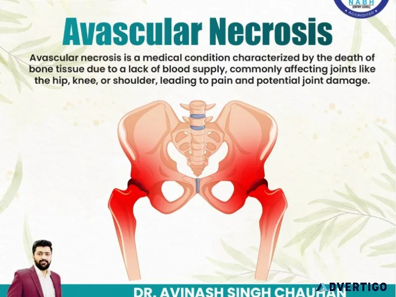 India’s best doctor for avascular necrosis – treat without surge