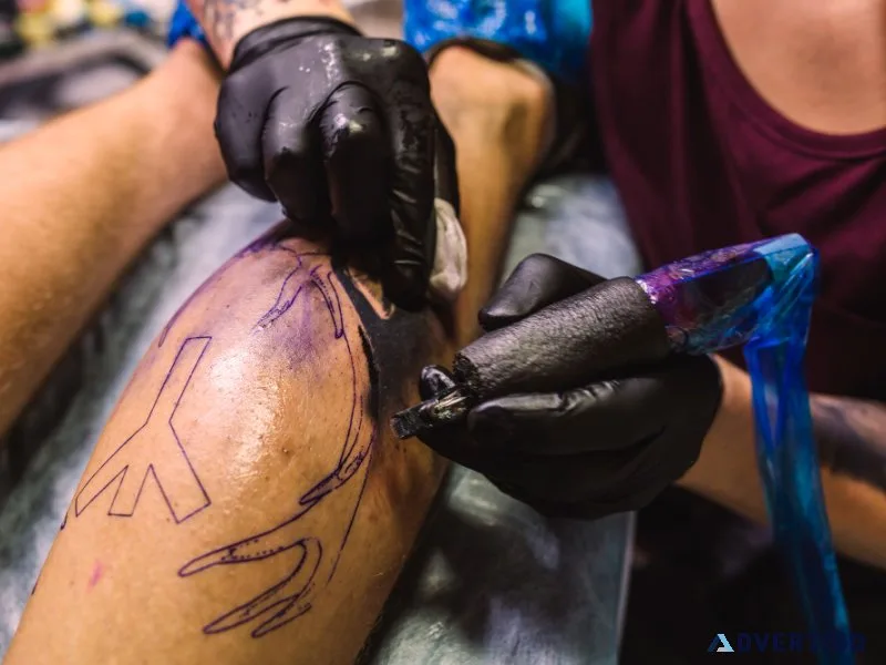 Tattoo removal in delhi – safe, effective & scar-free