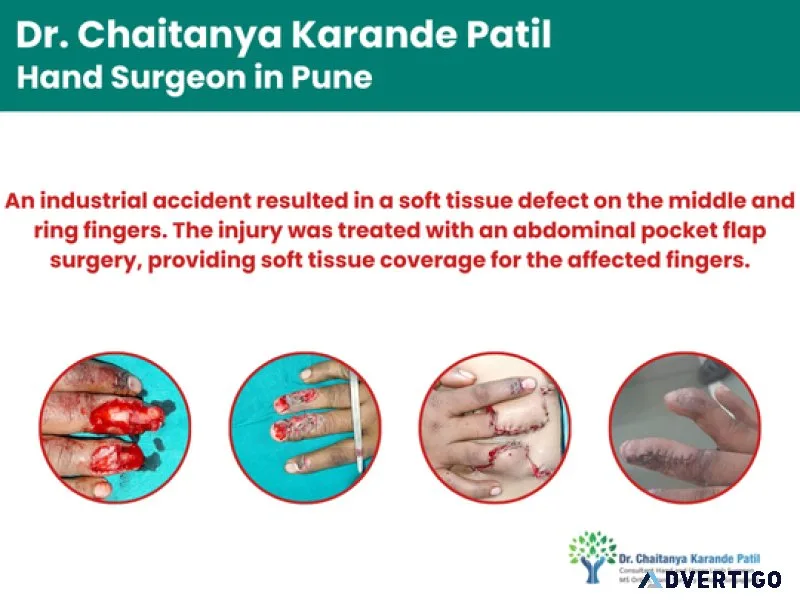 Dr chaitanya karande patil | best orthopedic doctor in pune, ko