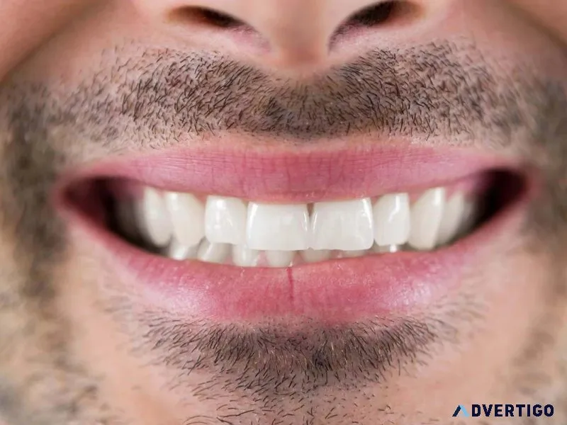 Teeth whitening in virar/ pravin dental