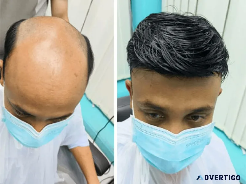 Smart hair fixing