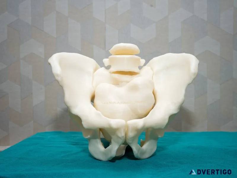 Curewith3d - get 3d precision in every 3d surgical models