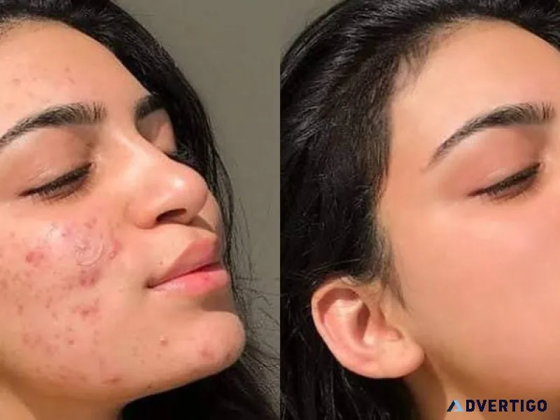 Photo retouching service
