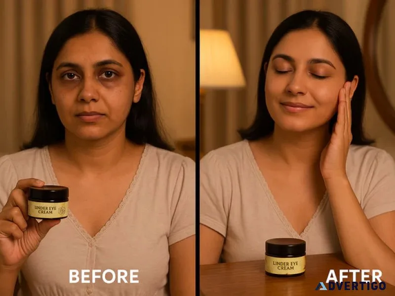 Purchase the best eye cream for wrinkles, natural and ayurvedic
