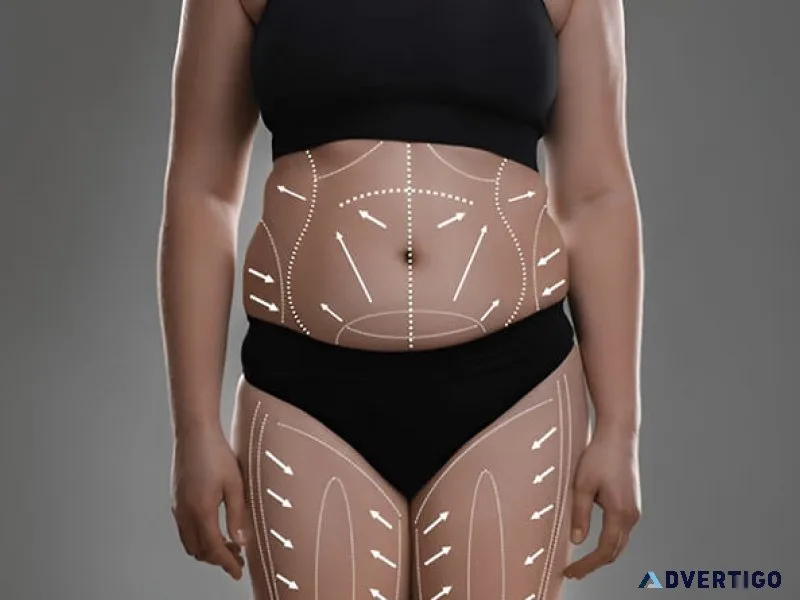 Can you get a brazilian butt lift with a tummy tuck?