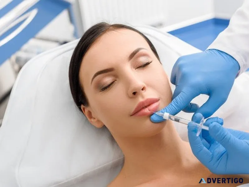 Lip fillers near me