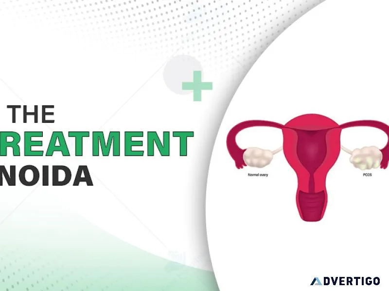 Pcos treatment in noida by expert doctors – cost guide