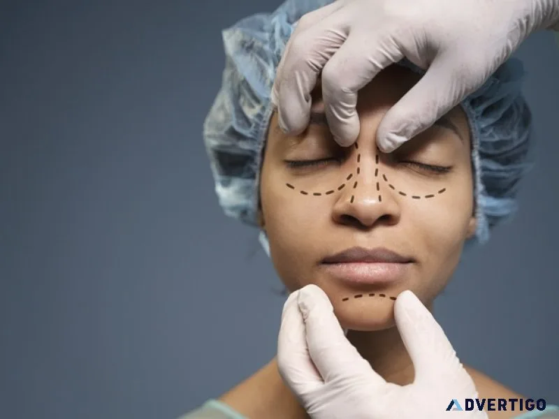 Expert rhinoplasty in lucknow by dr sumit malhotra