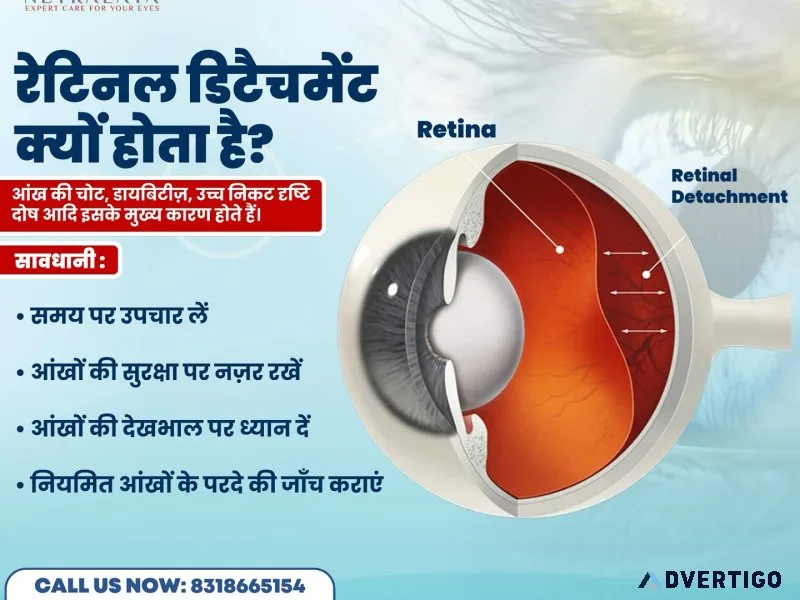 Retina specialist in varanasi – advanced retina care & treatment
