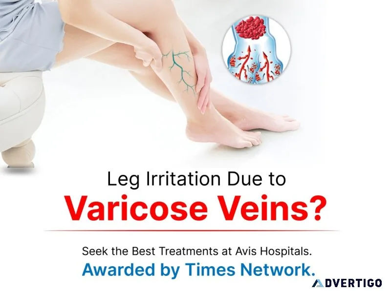 Varicose veins treatment in anantapur