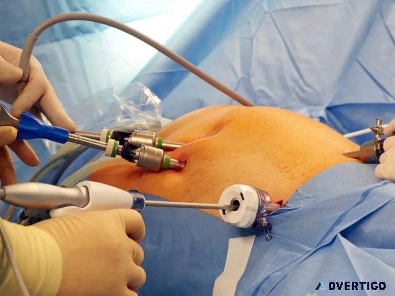 Laparoscopy training in india at world laparoscopy hospital