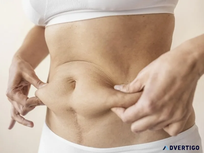 Looking for expert tummy tuck doctors in thane?