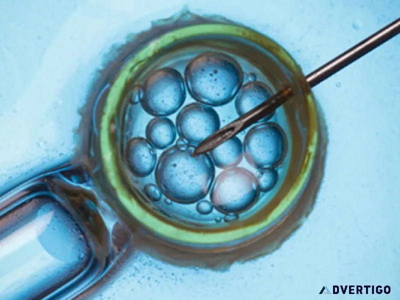 Top ivf treatment centre in bangalore