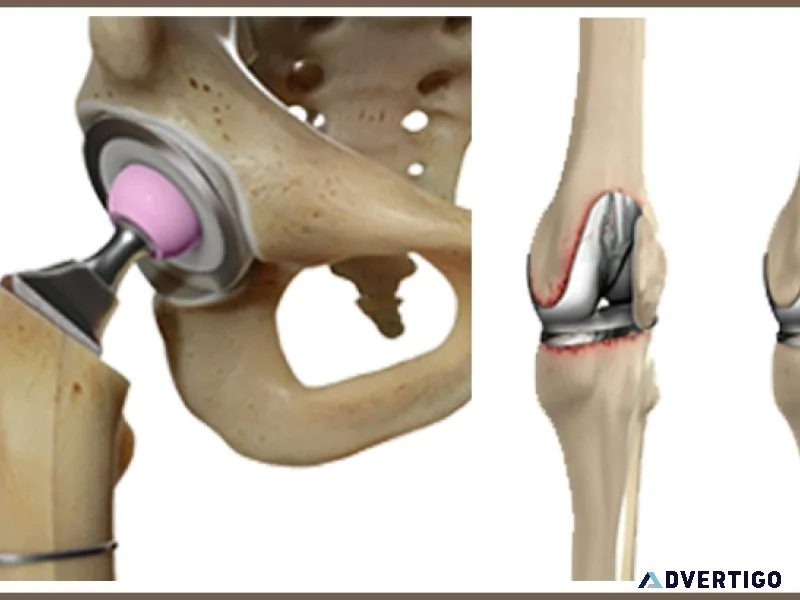 Revision knee & hip replacement surgery | elite ortho india