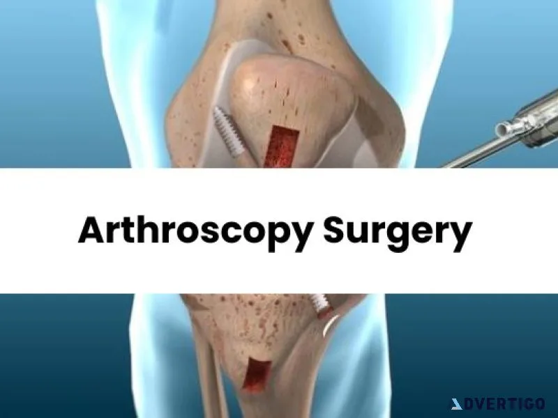 Arthroscopy surgery in punjab | elite orthopaedics