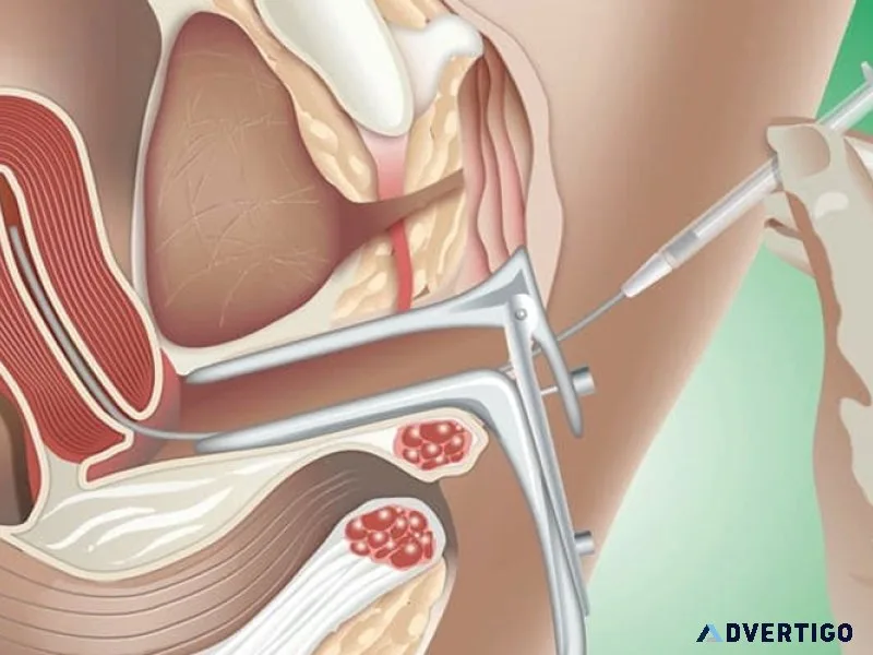 Best iui treatment in bangalore