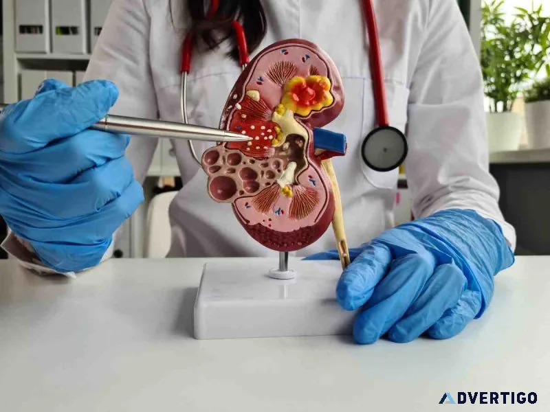 Kidney stone specialist – diagnosis and treatment guide