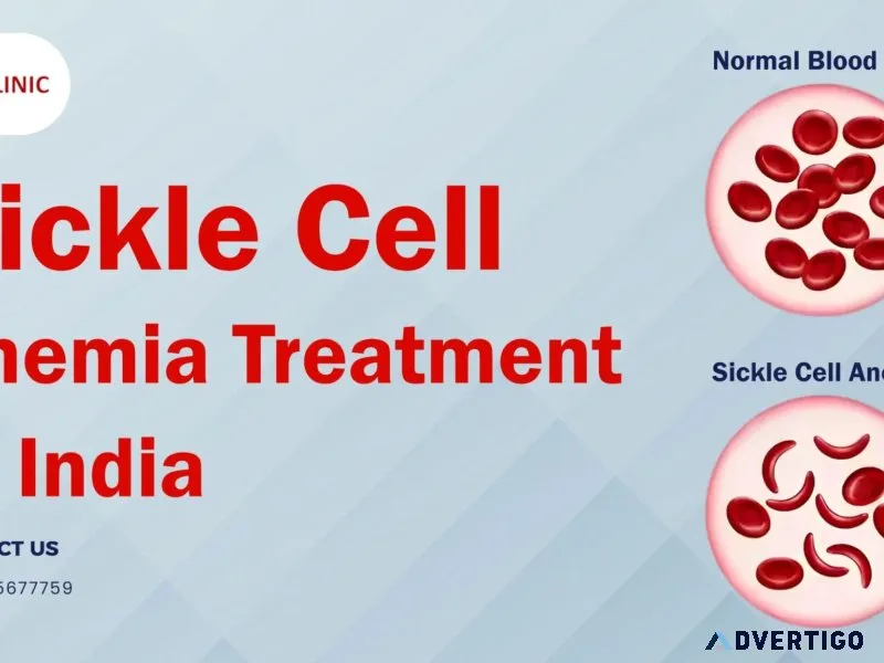 Affordable sickle cell anemia treatment cost in india | bmt clin