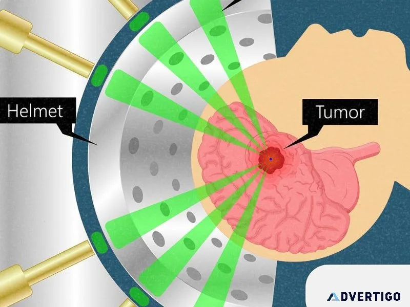 Best gamma knife radiosurgeons of india