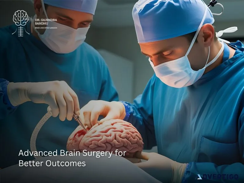 Brain surgeon in noida: expert care for complex neurological con