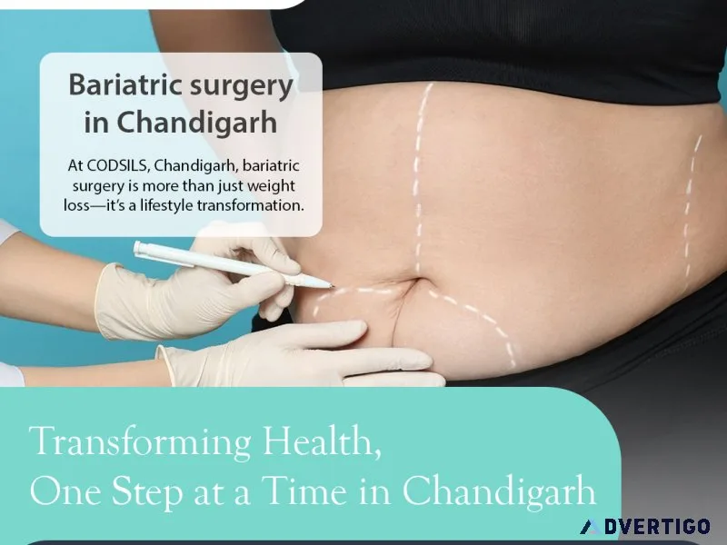 Top bariatric surgery centre, chandigarh – codsils