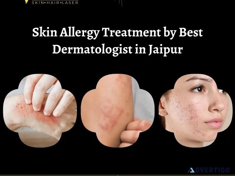 Skin allergy treatment by best dermatologist in jaipur