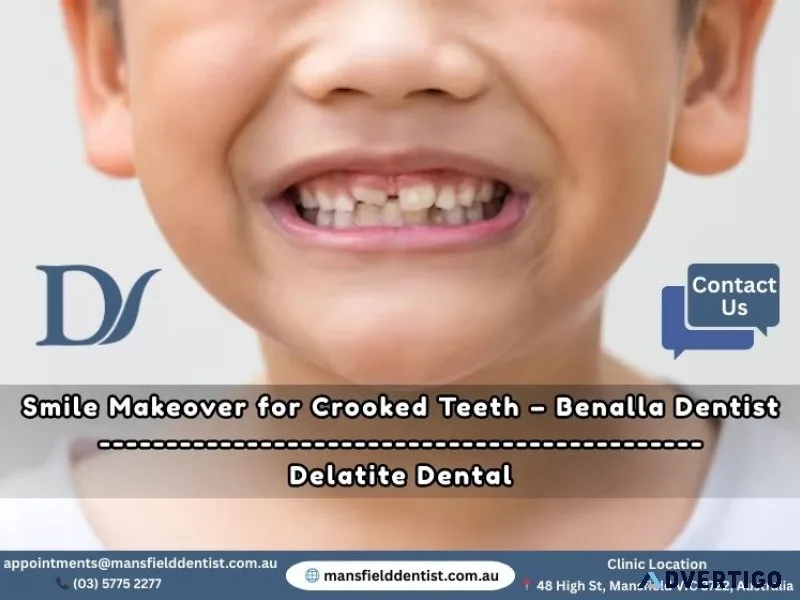 Smile makeover for crooked teeth – benalla dentist