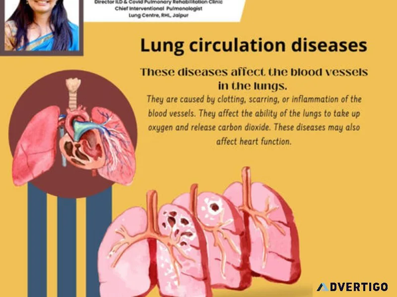 Experienced asthma specialist in jaipur – dr sheetu singh