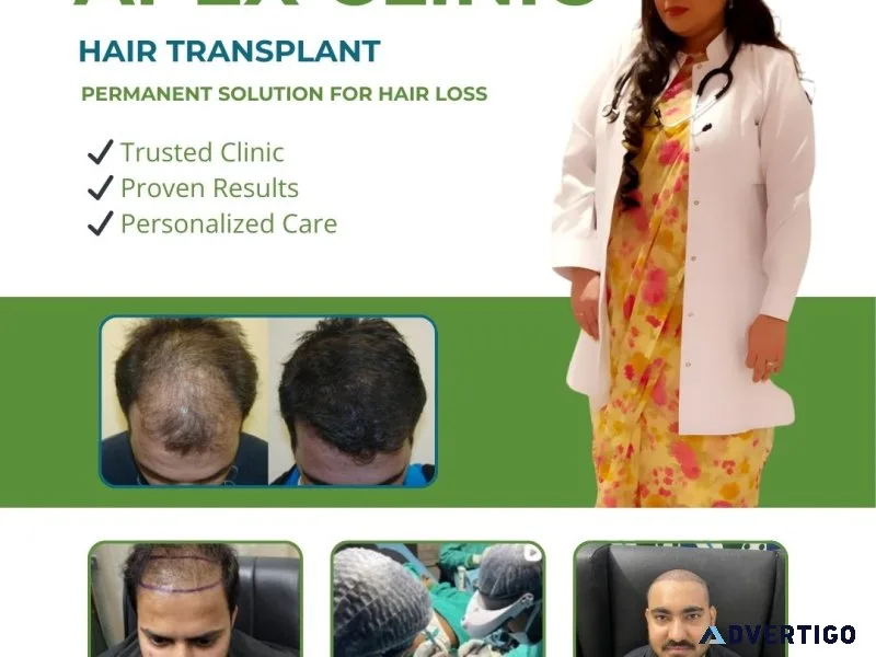 Hair transplant treatment – natural & permanent results