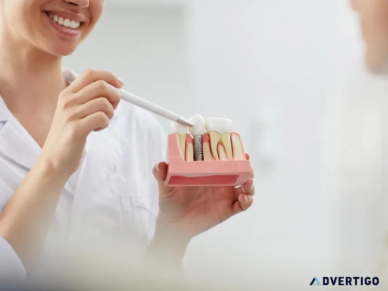 Get permanent dental implants in kurla with expert care