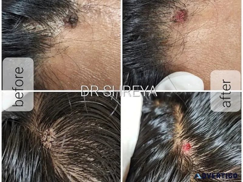 Nirmal Skin care and eye care Hospital