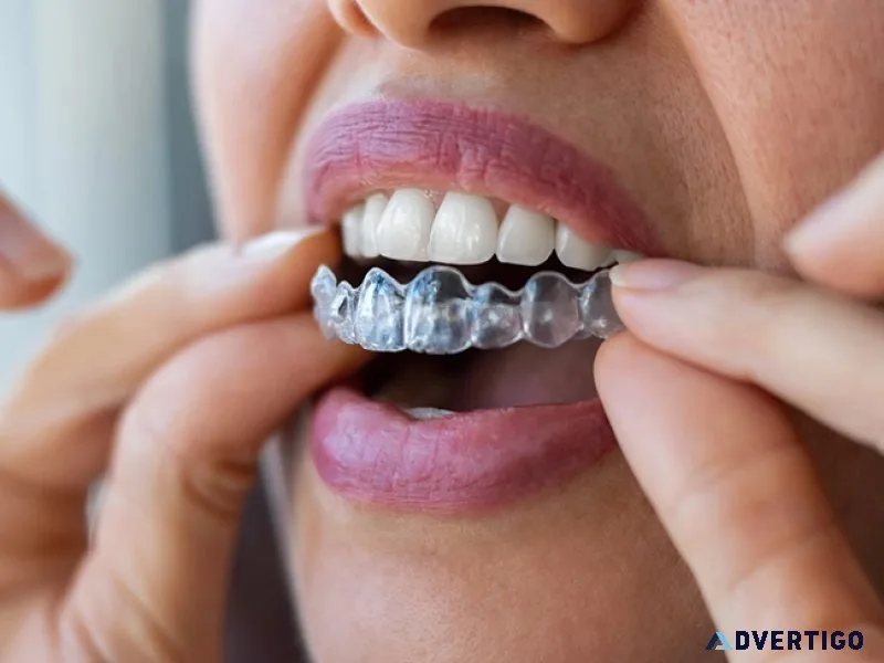 Orthodontist for invisible braces & clear aligners in alwarpet