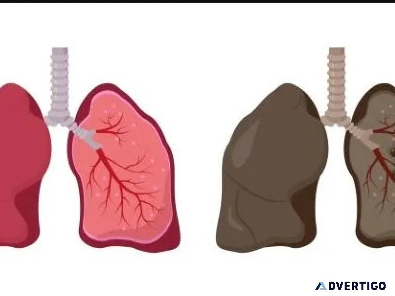 Tuberculosis specialist in jaipur, rajasthan | tb treatment expe