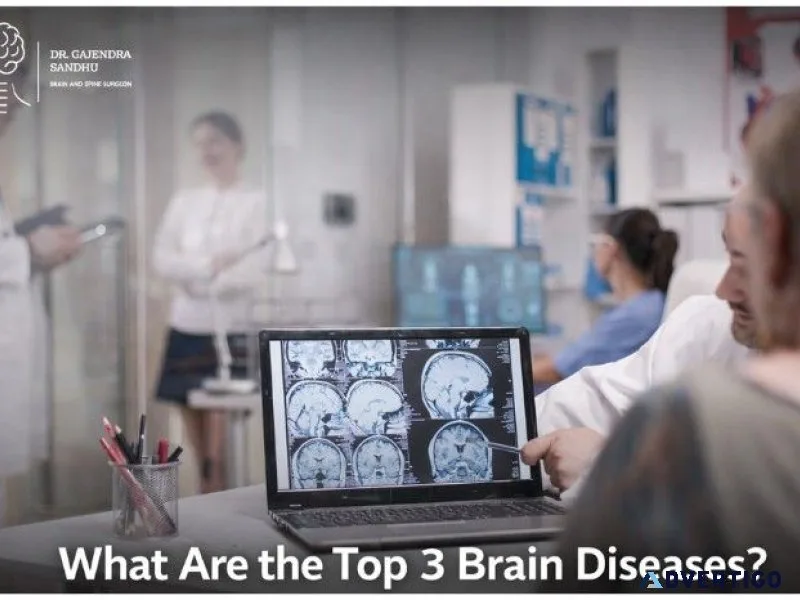 What are the top 3 brain diseases?