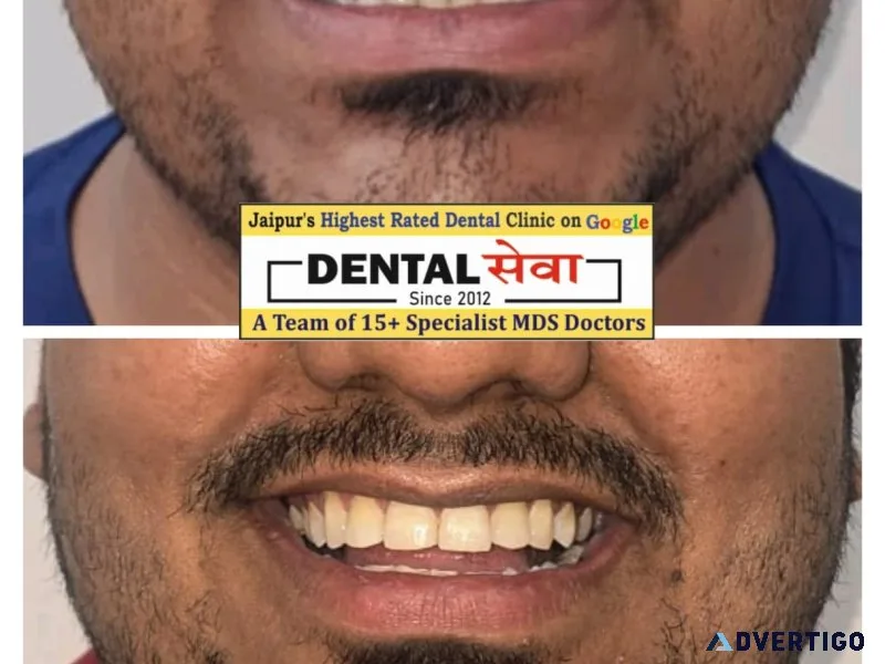 Dental hospital in vaishali nagar teeth braces jaipur dental