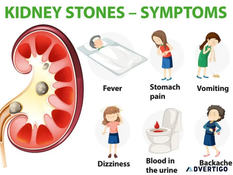 When to see a kidney stone specialist doctor for timely care
