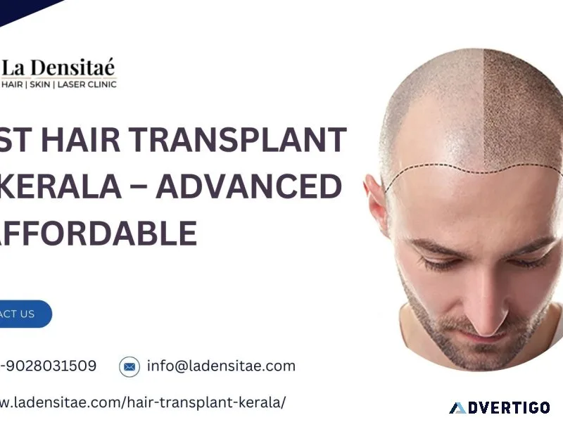 Best hair transplant in kerala advanced affordable