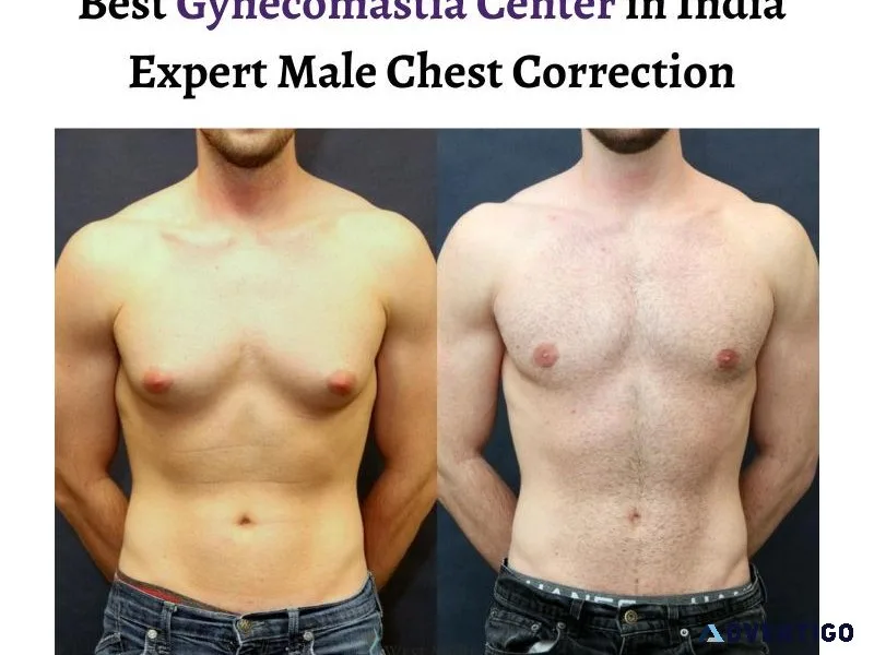 Best gynecomastia center in india expert male chest correction
