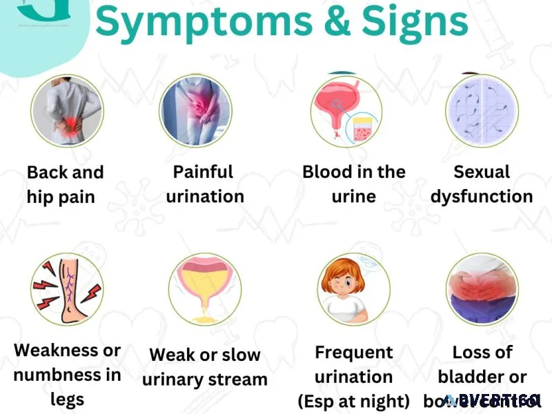 Why is choosing the best cancer specialist in yamunanagar