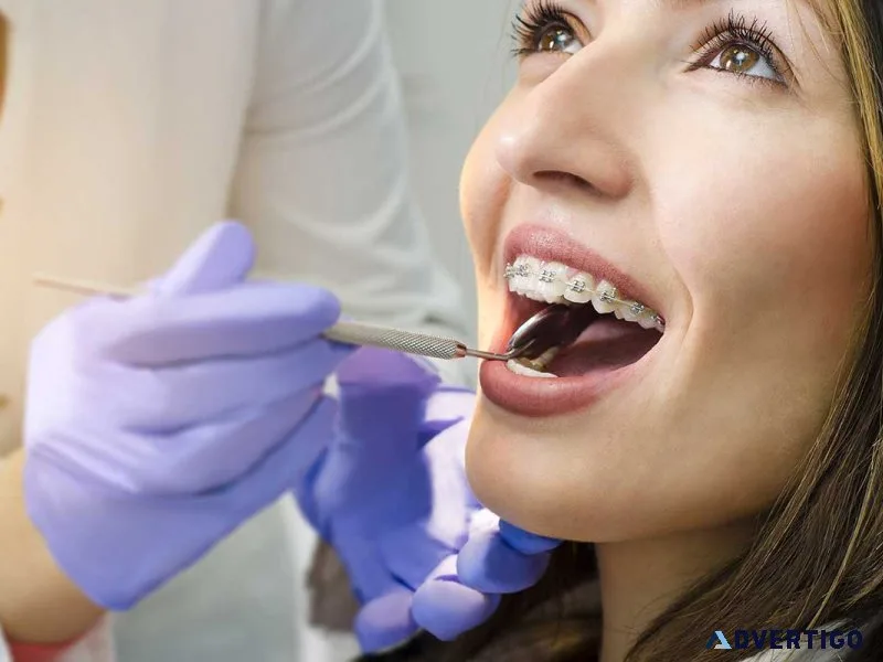 Emergency dentist fort worth